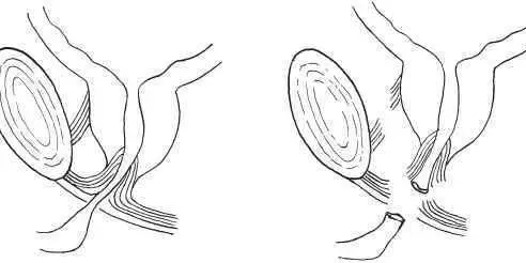 penis 6 Resim1 c
