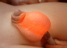 penis 6 Resim1 b