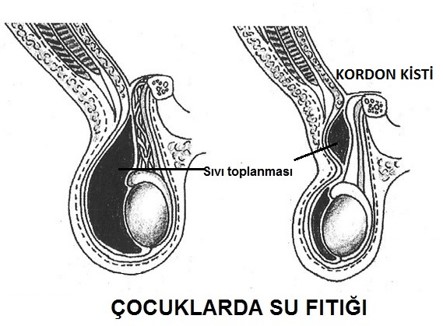 penis 6 Resim2 b