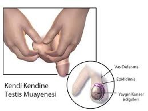 penis 9 Resim1 a