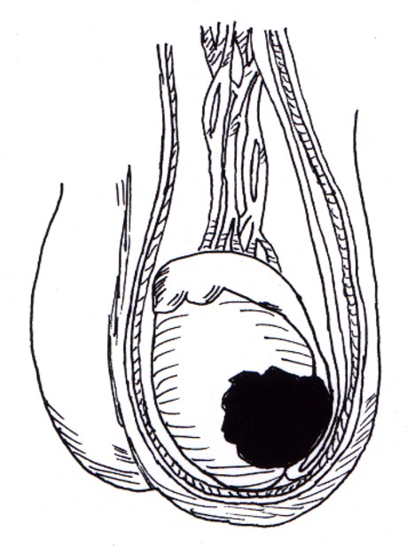 penis 9 Resim1 b